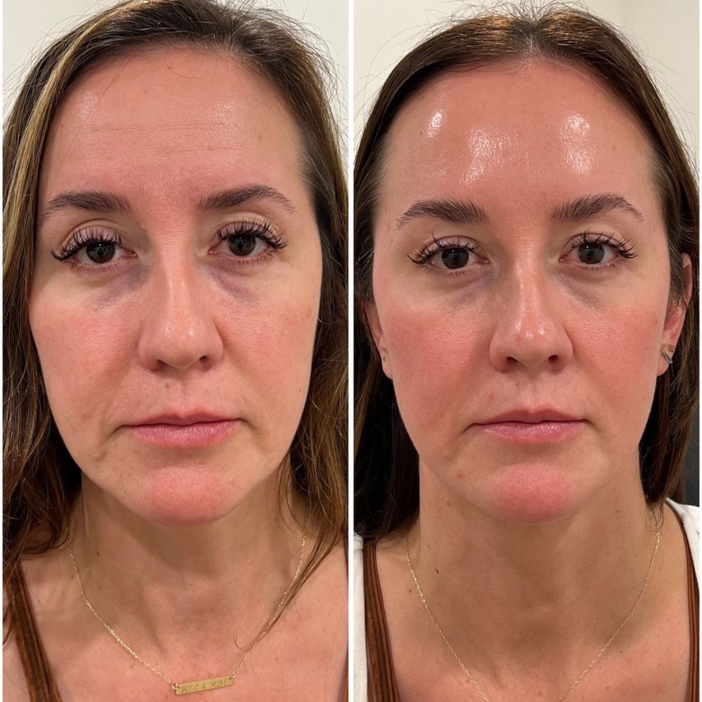 Michelle D., 49